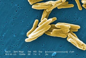 Mycobacterium tuberculosis (credit: CDC)